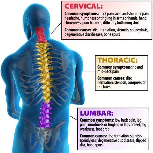 areas of back pain
